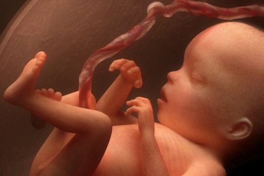 image d'un foetus de 6 mois